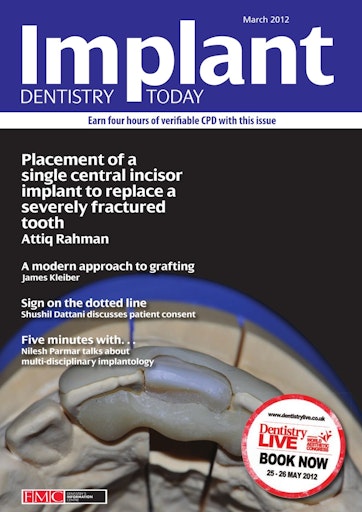 IDT – Implant Dentistry Today Preview
